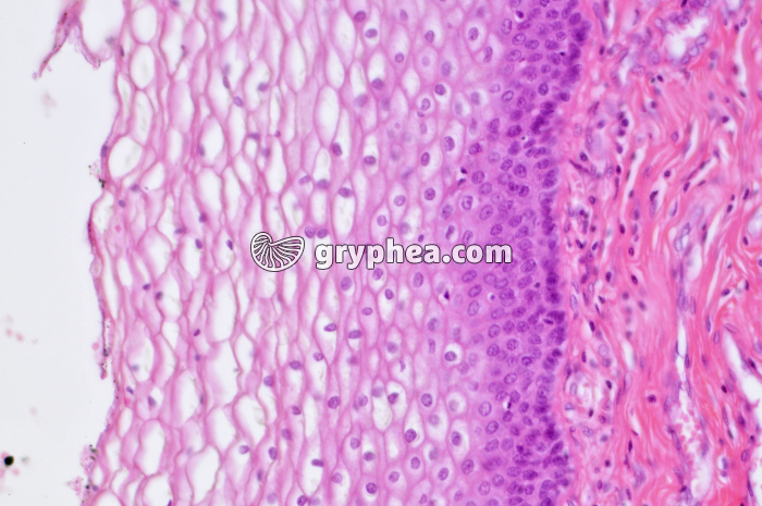 Vagin - muqueuse vaginale CT x100 - gryphea.com